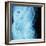 X-Ray of Intestines-Robert Llewellyn-Framed Photographic Print