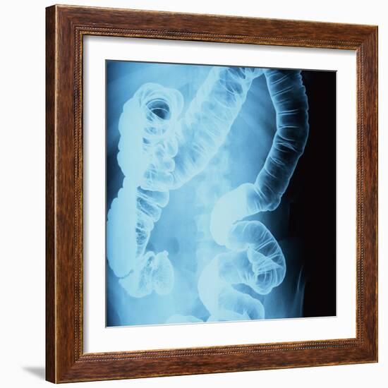 X-Ray of Intestines-Robert Llewellyn-Framed Photographic Print