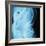 X-Ray of Intestines-Robert Llewellyn-Framed Photographic Print