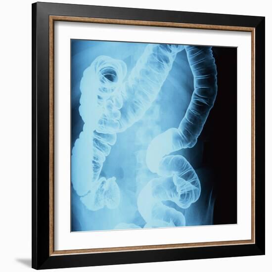 X-Ray of Intestines-Robert Llewellyn-Framed Photographic Print