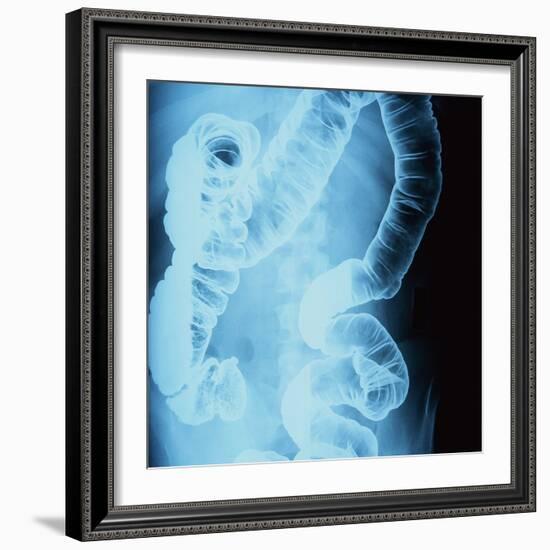 X-Ray of Intestines-Robert Llewellyn-Framed Photographic Print