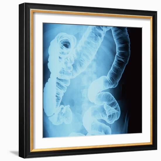 X-Ray of Intestines-Robert Llewellyn-Framed Photographic Print