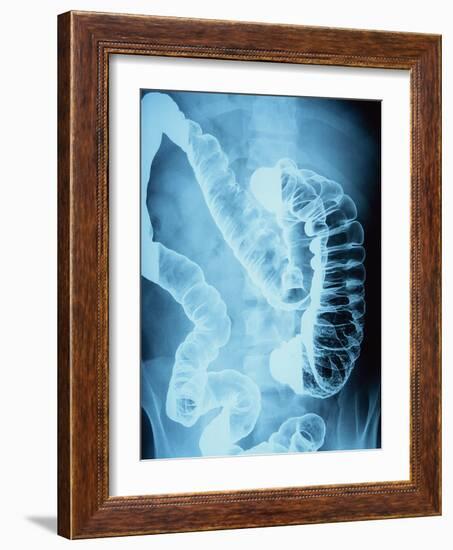 X-Ray of Intestines-Robert Llewellyn-Framed Photographic Print