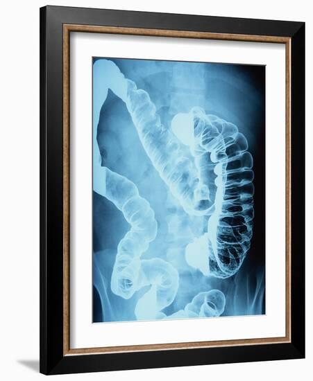 X-Ray of Intestines-Robert Llewellyn-Framed Photographic Print