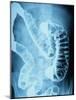 X-Ray of Intestines-Robert Llewellyn-Mounted Photographic Print