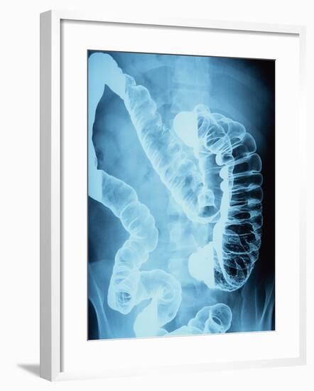 X-Ray of Intestines-Robert Llewellyn-Framed Photographic Print