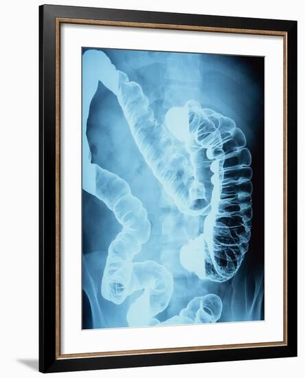 X-Ray of Intestines-Robert Llewellyn-Framed Photographic Print