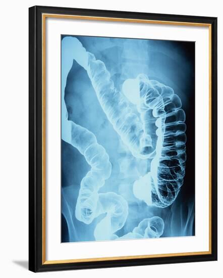 X-Ray of Intestines-Robert Llewellyn-Framed Photographic Print