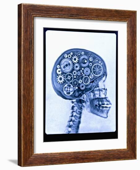 X-ray of skull with gears-Thom Lang-Framed Photographic Print