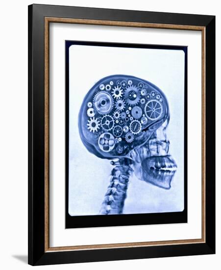 X-ray of skull with gears-Thom Lang-Framed Photographic Print