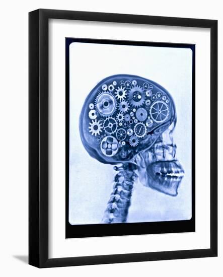 X-ray of skull with gears-Thom Lang-Framed Photographic Print
