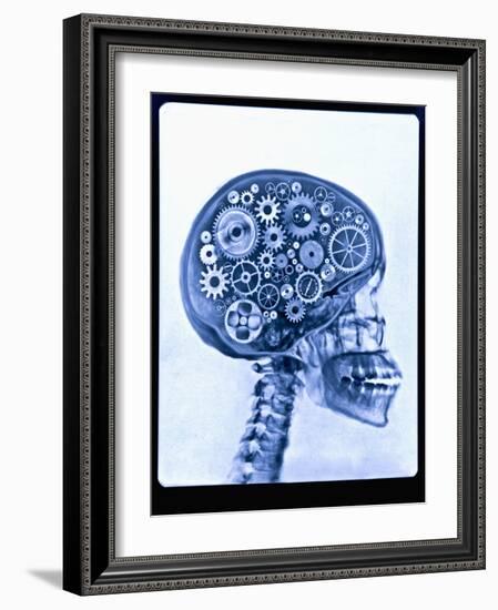 X-ray of skull with gears-Thom Lang-Framed Photographic Print