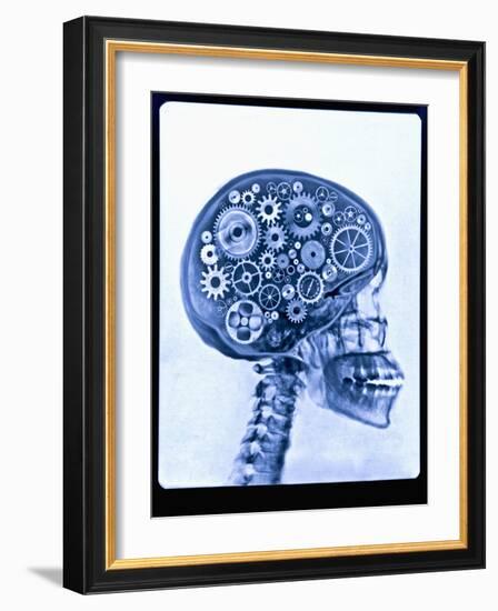 X-ray of skull with gears-Thom Lang-Framed Photographic Print