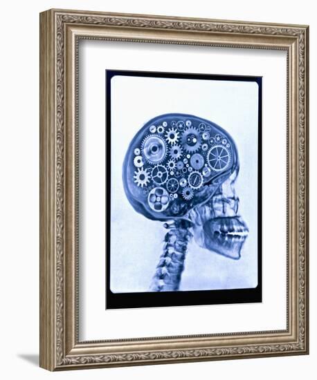 X-ray of skull with gears-Thom Lang-Framed Photographic Print