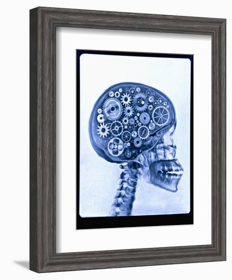 X-ray of skull with gears-Thom Lang-Framed Photographic Print