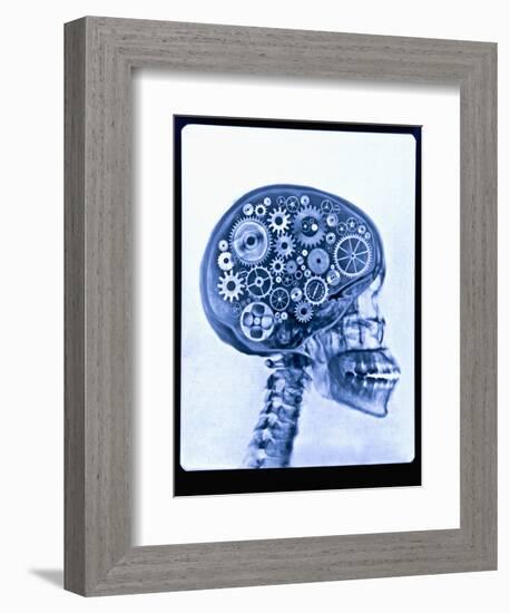 X-ray of skull with gears-Thom Lang-Framed Photographic Print