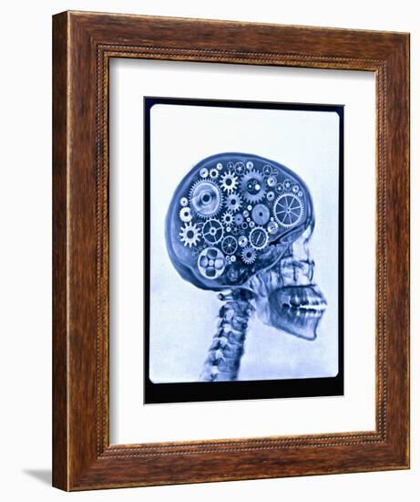 X-ray of skull with gears-Thom Lang-Framed Photographic Print