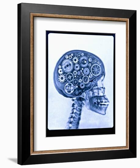 X-ray of skull with gears-Thom Lang-Framed Photographic Print