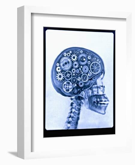 X-ray of skull with gears-Thom Lang-Framed Photographic Print