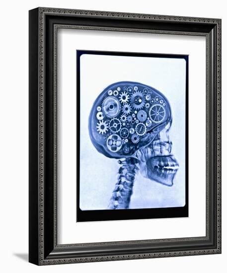 X-ray of skull with gears-Thom Lang-Framed Photographic Print