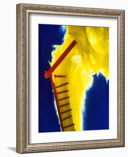 X-ray of the Broken Head of the Femur-Science Photo Library-Framed Photographic Print