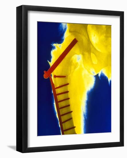 X-ray of the Broken Head of the Femur-Science Photo Library-Framed Photographic Print