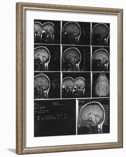 X-Ray Photographs of Person's Skull-null-Framed Photographic Print