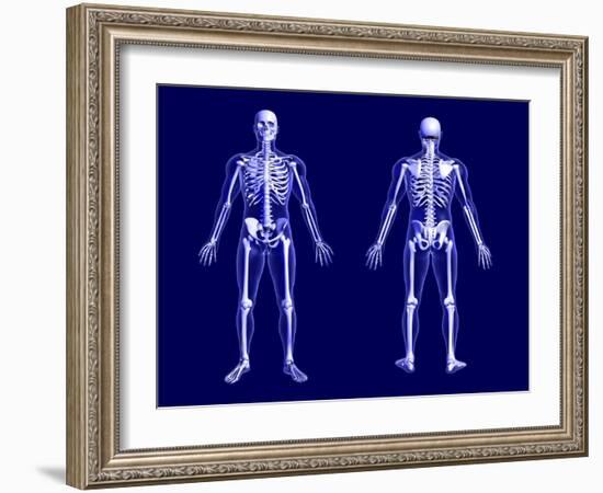 X-Ray Skeleton on Blue-AlienCat-Framed Art Print