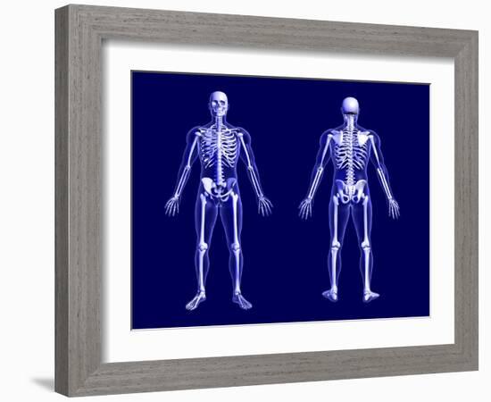 X-Ray Skeleton on Blue-AlienCat-Framed Art Print
