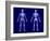 X-Ray Skeleton on Blue-AlienCat-Framed Art Print