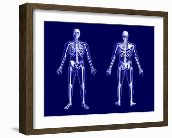 X-Ray Skeleton on Blue-AlienCat-Framed Art Print