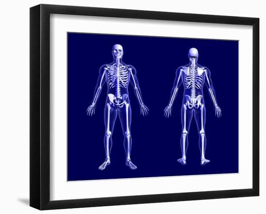 X-Ray Skeleton on Blue-AlienCat-Framed Art Print