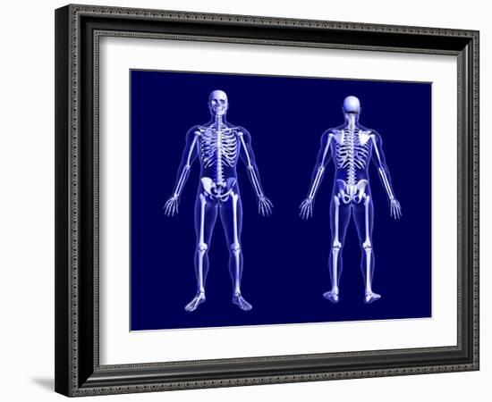 X-Ray Skeleton on Blue-AlienCat-Framed Art Print