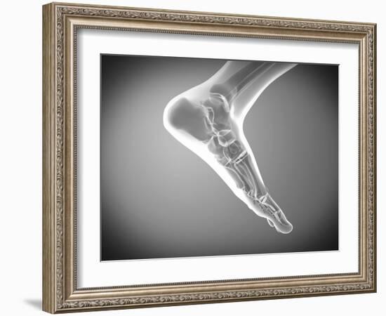 X-ray View of Human Foot-Stocktrek Images-Framed Photographic Print