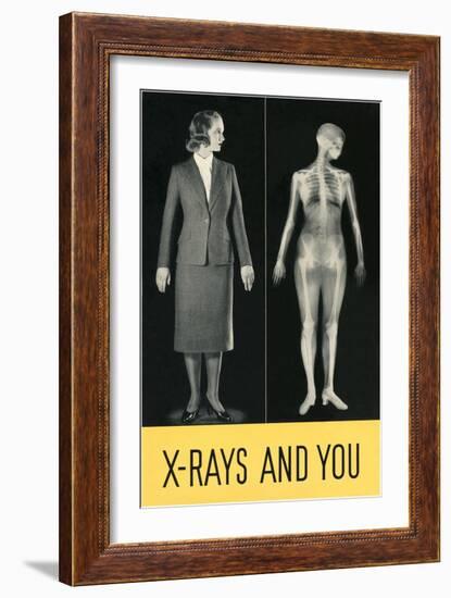 X-Rays and You-null-Framed Premium Giclee Print