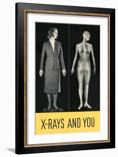 X-Rays and You-null-Framed Premium Giclee Print