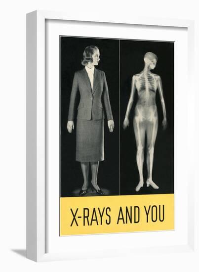 X-Rays and You-null-Framed Premium Giclee Print