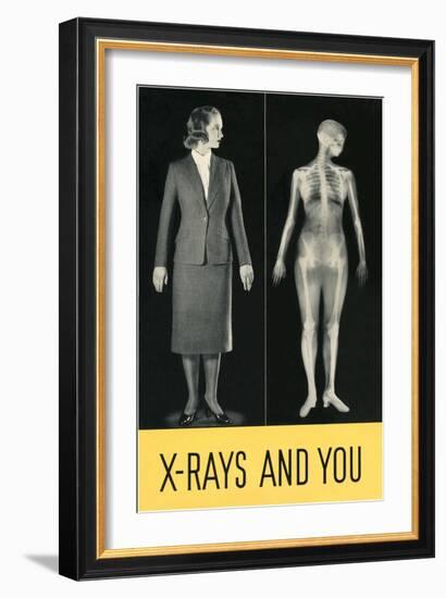 X-Rays and You-null-Framed Premium Giclee Print