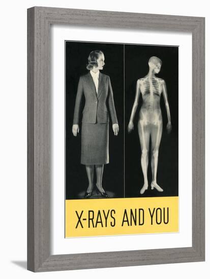 X-Rays and You-null-Framed Art Print