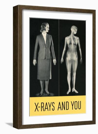 X-Rays and You-null-Framed Art Print