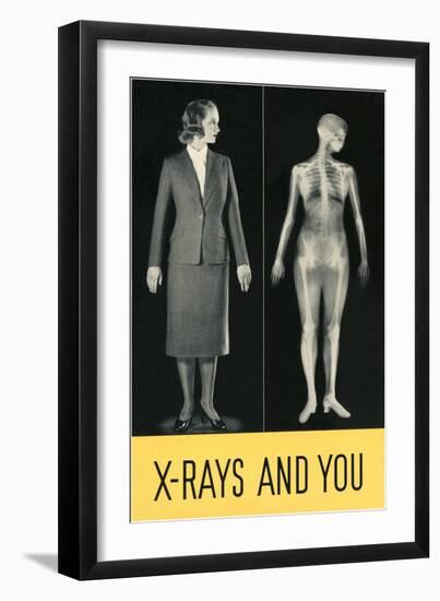 X-Rays and You-null-Framed Art Print