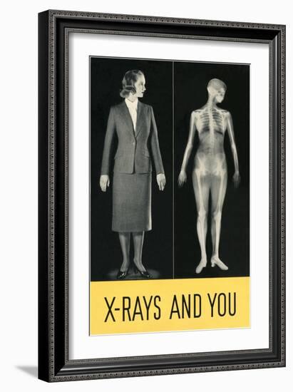 X-Rays and You-null-Framed Art Print