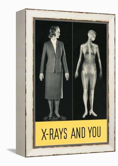 X-Rays and You-null-Framed Stretched Canvas