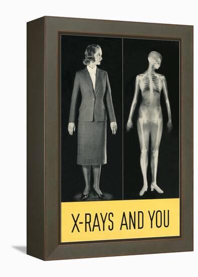 X-Rays and You-null-Framed Stretched Canvas