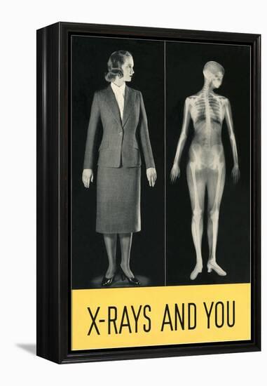 X-Rays and You-null-Framed Stretched Canvas