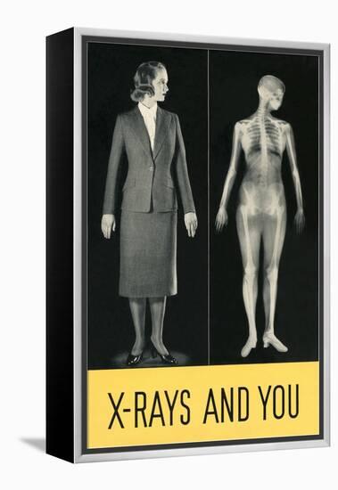 X-Rays and You-null-Framed Stretched Canvas