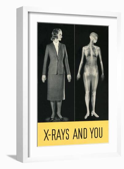 X-Rays and You-null-Framed Giclee Print