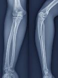 Normal Foot, 3D CT Scan-ZEPHYR-Premium Photographic Print