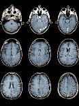 Normal Brain, MRI Scans-ZEPHYR-Photographic Print