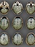 Normal Brain, MRI Scans-ZEPHYR-Framed Photographic Print